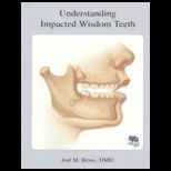Understanding Impacted Wisdom Teeth