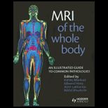 MRI of the Whole Body