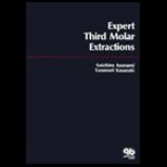 Expert Third Molar Extractions