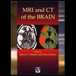 MRI and Ct of the Brain