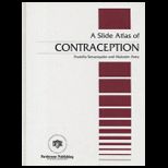 Slide Atlas of Contraception