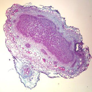 Legume Nodule, sec., 12 µm Microscope Slide