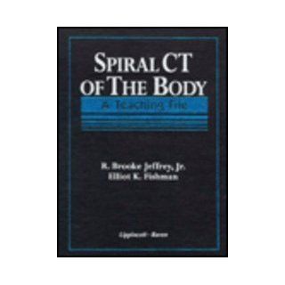 Spiral CT of the Body A Teaching File (9780387711386) R. Brooke Jeffrey Jr.  MD, Elliot K. Fishman Books