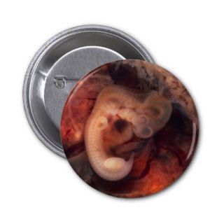 Human Embryo 7th Week of Pregnancy 5th Peek P.O. Pinback Buttons