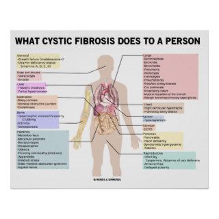 What Cystic Fibrosis Does To A Person (Anatomical) Posters