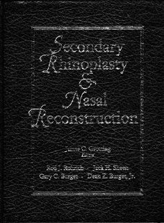 Secondary Rhinoplasty and Nasal Reconstruction (9780942219807) Rod J. Rohrich, Jack H. Sheen, James C. Grotting, Gary Burget Books