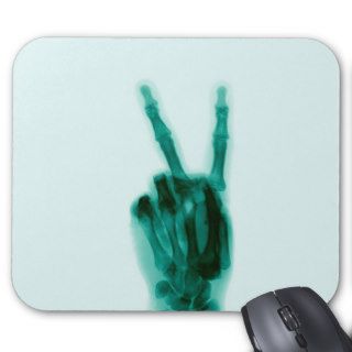 X Ray of Hand Doing Peace Sign Mousepads