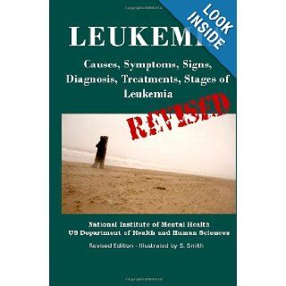 Leukemia Causes, Symptoms, Signs, Diagnosis, Treatments, Stages of Leukemia   Revised Edition   Illustrated by S. Smith Department of Health and Human Services, National Institutes of Health, National Cancer Institute, S. Smith 9781470016715 Books