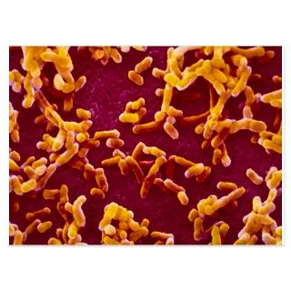 Yersinia pestis (plague) bacteria   4.5 by sciencephotos