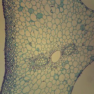 Collenchyma Tissue, c.s., 12 µm Microscope Slide
