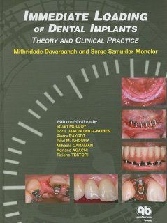 Immediate Loading of Dental Implants Theory and Clinical Practice 9782912550507 Medicine & Health Science Books @