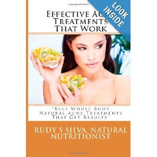 Effective Acne Treatments That Work "Best Whole Body Natural Acne Treatments That Get Results" Rudy Silva Silva 9781482579239 Books