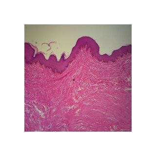 Human Heavily Pigmented Skin sec. 7 µm H&E stain Microscope Slide
