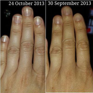 Mavala Stop   Helps Cure Nail Biting and Thumb Sucking, 0.3 Fluid Ounce  Nail Repair Products  Beauty