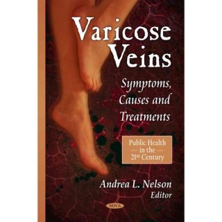 Varicose Veins Symptoms, Causes and Treatments